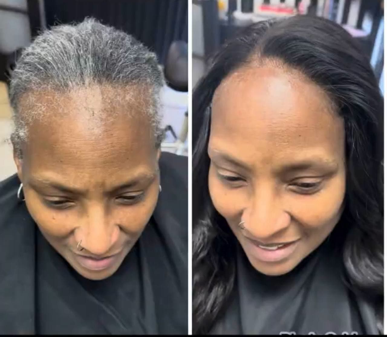 Before and after Mesh Integration on a hair loss client at CymbolizeBeauty